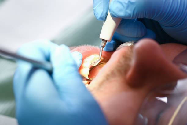Best Broken or Chipped Tooth Repair in Cherry Hills Village, CO